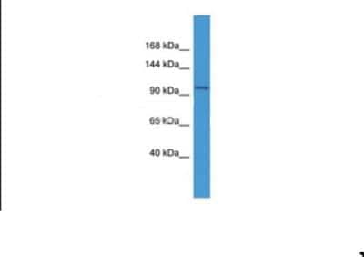 Western Blot: IGHMBP2 Antibody [NBP1-68921]