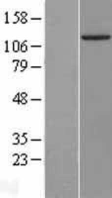 Western Blot: IGHMBP2 Overexpression Lysate [NBL1-11878]