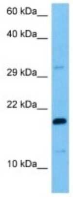 Western Blot: IGHV1-61 Antibody [NBP3-10178]