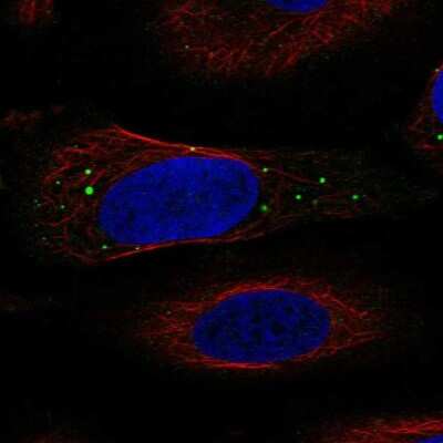 Immunocytochemistry/ Immunofluorescence: IGIP Antibody [NBP2-58982]