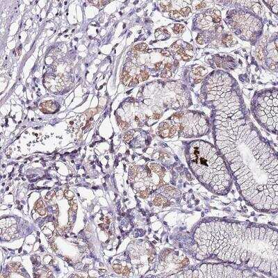 Immunohistochemistry-Paraffin: IGIP Antibody [NBP2-14118]