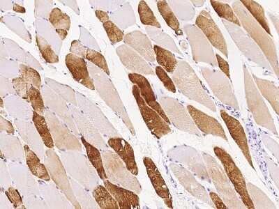 Immunohistochemistry-Paraffin: IGIP Antibody [NBP2-98511]