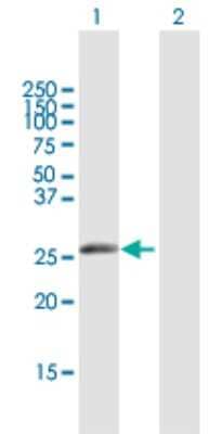 Western Blot: IGKV1-5 Antibody [H00028299-B01P]