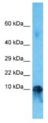 Western Blot: IGLC7 Antibody [NBP3-09920]