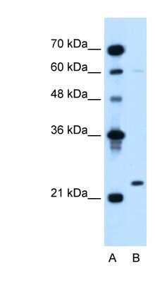 Western Blot: Lambda5/IGLL1 Antibody [NBP1-58333]