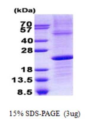 SDS-PAGE: Recombinant Human Lambda5/IGLL1 His Protein [NBP2-23133]