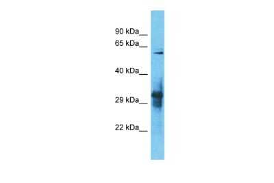 Western Blot: IGLON5 Antibody [NBP2-83075]