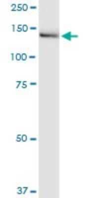 Western Blot: IGSF1 Antibody (4C7) [H00003547-M01]