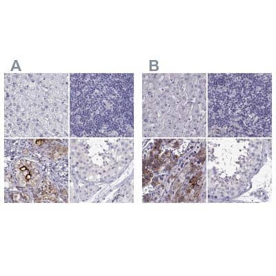 Immunohistochemistry-Paraffin: IGSF1 Antibody [NBP2-14119]