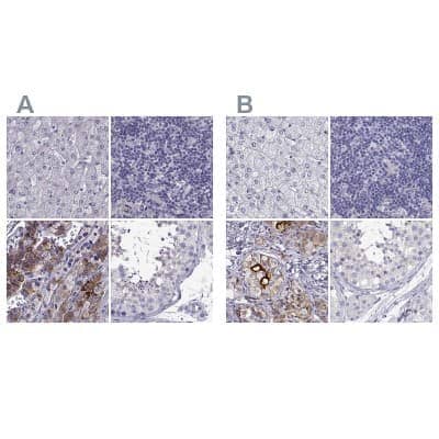 Immunohistochemistry-Paraffin: IGSF1 Antibody [NBP2-68582]