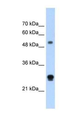 Western Blot: IGSF1 Antibody [NBP1-59109]