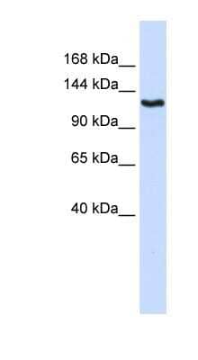 Western Blot: IGSF1 Antibody [NBP1-59245]