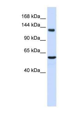 Western Blot: IGSF1 Antibody [NBP1-59246]