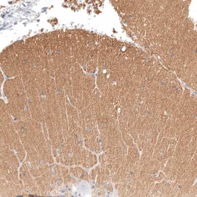 Immunohistochemistry-Paraffin: IGSF21 Antibody [NBP1-81191]