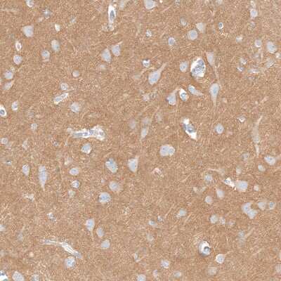 Immunohistochemistry-Paraffin: IGSF21 Antibody [NBP1-81191]