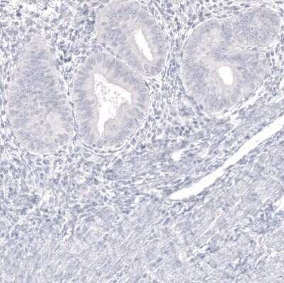 Immunohistochemistry-Paraffin: IGSF21 Antibody [NBP1-81191]