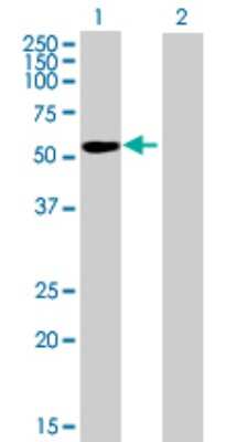 Western Blot: IGSF21 Antibody [H00084966-B01P]