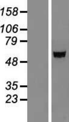 Western Blot: IGSF21 Overexpression Lysate [NBL1-11883]