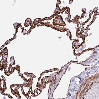 Immunohistochemistry-Paraffin: IGSF23 Antibody [NBP2-33722]