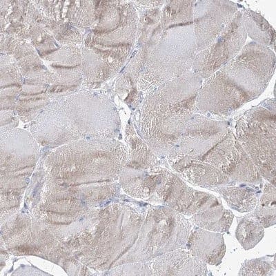 Immunohistochemistry-Paraffin: IGSF3 Antibody [NBP2-38292]