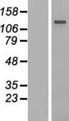 Western Blot: IGSF3 Overexpression Lysate [NBP2-08813]