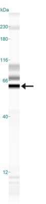Simple Western: IGSF4A/SynCAM1/CADM1 Antibody [NB300-186]