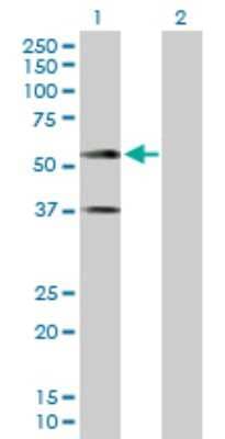 Western Blot: IGSF4A/SynCAM1/CADM1 Antibody [H00023705-D01P]