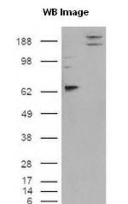 Western Blot: IGSF4A/SynCAM1/CADM1 Antibody [NB300-186]