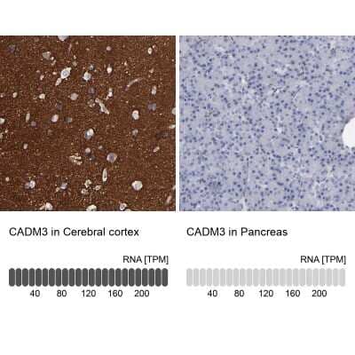 Immunohistochemistry-Paraffin: IGSF4B/SynCAM3/CADM3 Antibody [NBP1-88604]