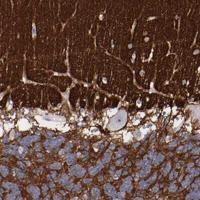 Immunohistochemistry-Paraffin: IGSF4B/SynCAM3/CADM3 Antibody [NBP1-88604]
