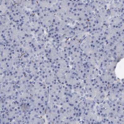 Immunohistochemistry-Paraffin: IGSF4B/SynCAM3/CADM3 Antibody [NBP1-88604]