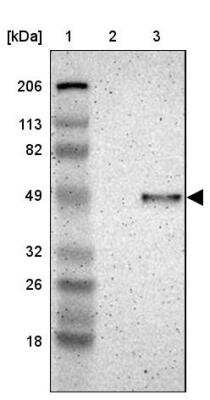 Western Blot: IGSF4B/SynCAM3/CADM3 Antibody [NBP1-88604]