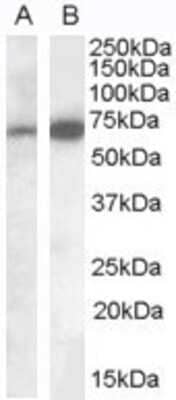 Western Blot: IGSF4C/SynCAM4 Antibody [NB100-93383]