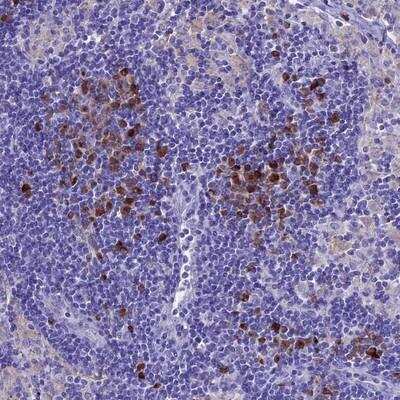 Immunohistochemistry-Paraffin: IGSF6/DORA Antibody [NBP1-84061]