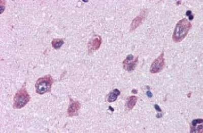 Immunohistochemistry-Paraffin: IGSF8/CD316 Antibody [NBP3-14380]