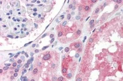 Immunohistochemistry-Paraffin: IGSF8/CD316 Antibody [NBP3-14381]