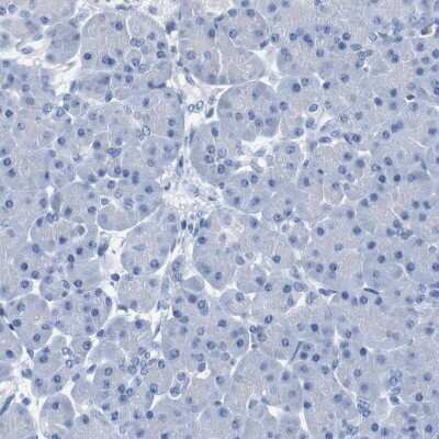 Immunohistochemistry-Paraffin: IGSF8/CD316 Antibody [NBP1-85761]