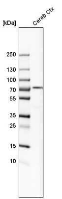 Western Blot: IGSF8/CD316 Antibody [NBP1-85761]