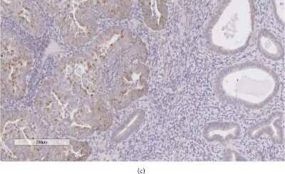 Immunohistochemistry: IGSF9 Antibody [NBP1-93676]