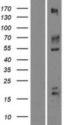 Western Blot: IGSF9B Overexpression Lysate [NBP2-07236]