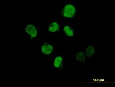 Immunocytochemistry/ Immunofluorescence: IHPK2 Antibody [H00051447-B01P]