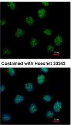 Immunocytochemistry/ Immunofluorescence: IHPK2 Antibody [NBP1-32322]