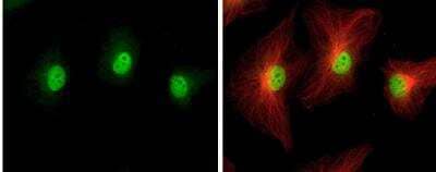 Immunocytochemistry/ Immunofluorescence: IHPK2 Antibody [NBP1-32322]