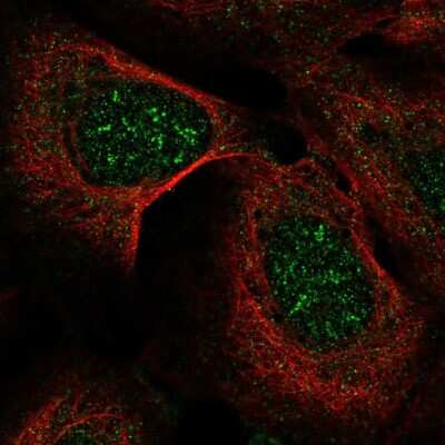 Immunocytochemistry/ Immunofluorescence: IHPK2 Antibody [NBP2-68909]