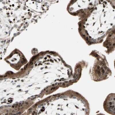 Immunohistochemistry-Paraffin: IHPK2 Antibody [NBP1-89635]