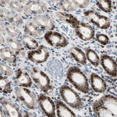 Immunohistochemistry-Paraffin: IHPK2 Antibody [NBP1-89635]