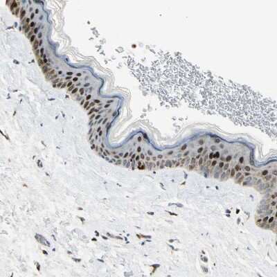 Immunohistochemistry-Paraffin: IHPK2 Antibody [NBP1-89635]