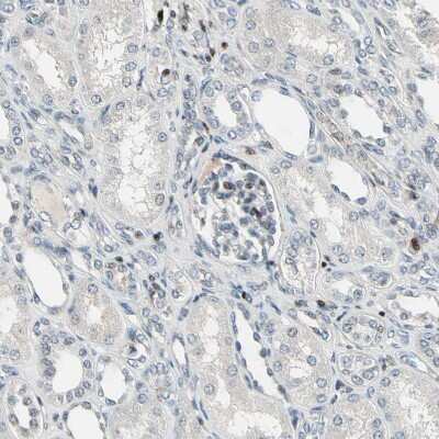 Immunohistochemistry-Paraffin: IHPK2 Antibody [NBP1-89635]