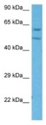 Western Blot: IHPK2 Antibody [NBP3-10132]