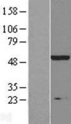 Western Blot: IHPK2 Overexpression Lysate [NBL1-11886]